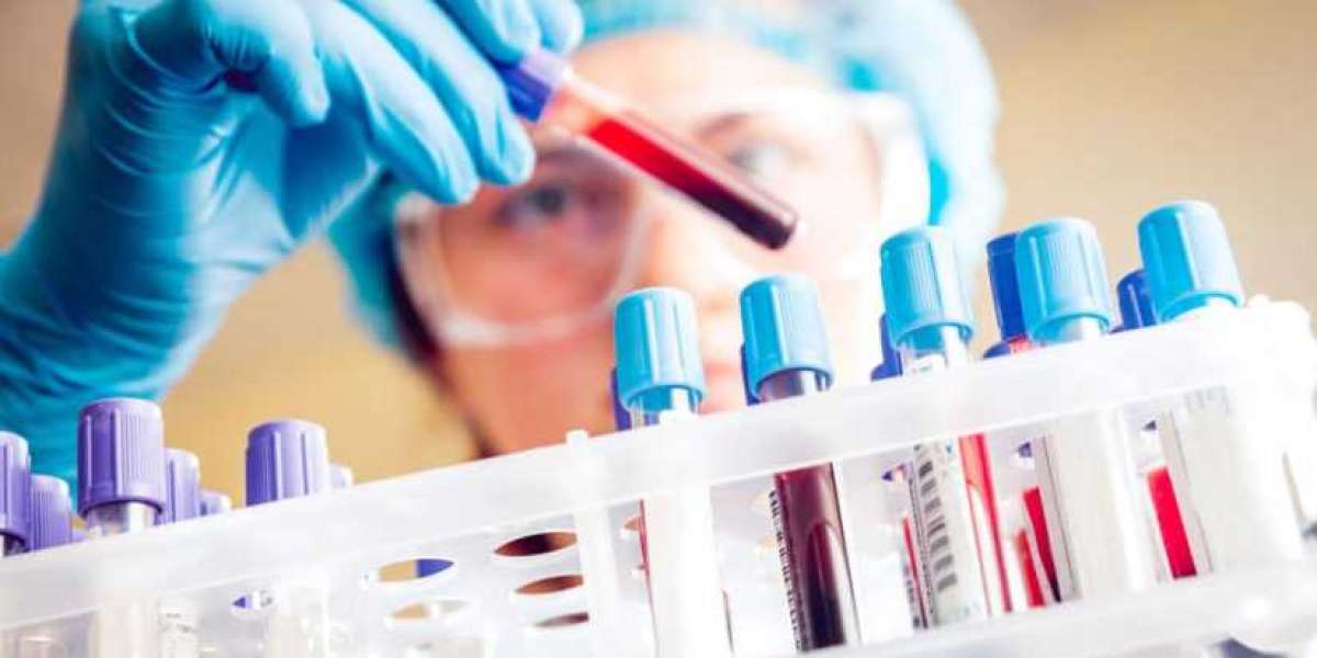 Clinical Laboratory Services Market Opportunities, Top Key Manufacturers and Supply Demand 2028