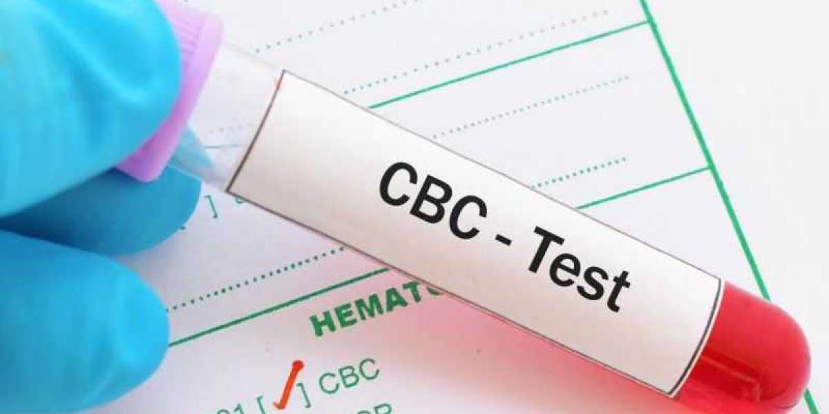 Assess Your Overall Health With CBC Blood Test in Chennai