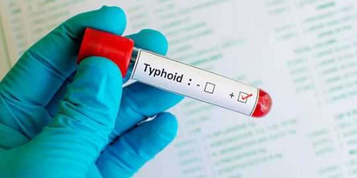 Diagnostic Accuracy and Reliability of Typhoid Tests in Chennai