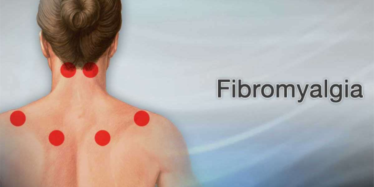 Unveiling the Uncommon: Exploring Rare Fibromyalgia Symptoms