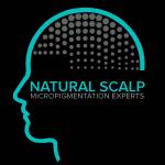 Natural Scalp Profile Picture