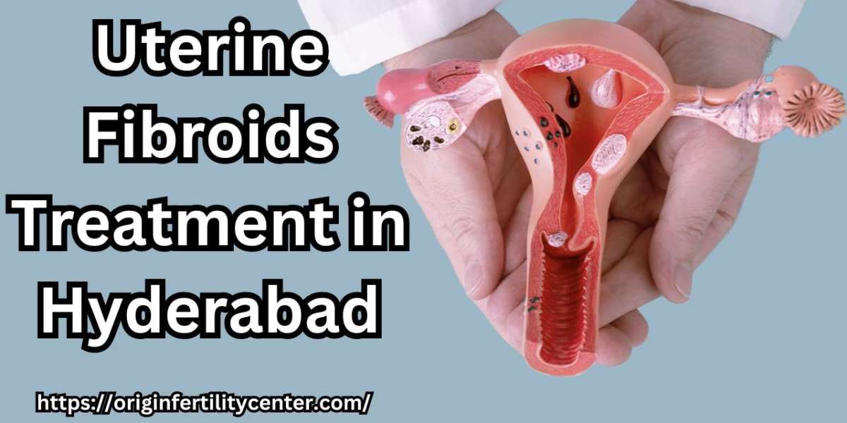 What is a Uterine Fibroid? What are its causes and symptoms?