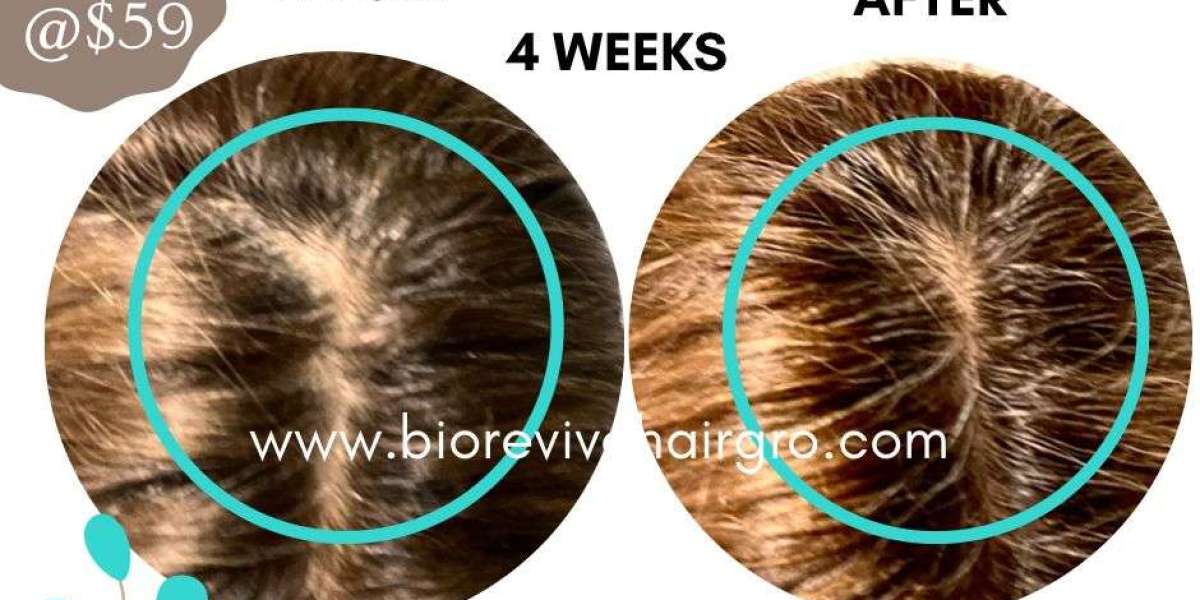 Transform Your Hair with BioReviveHairGro: The Top 10 Benefits