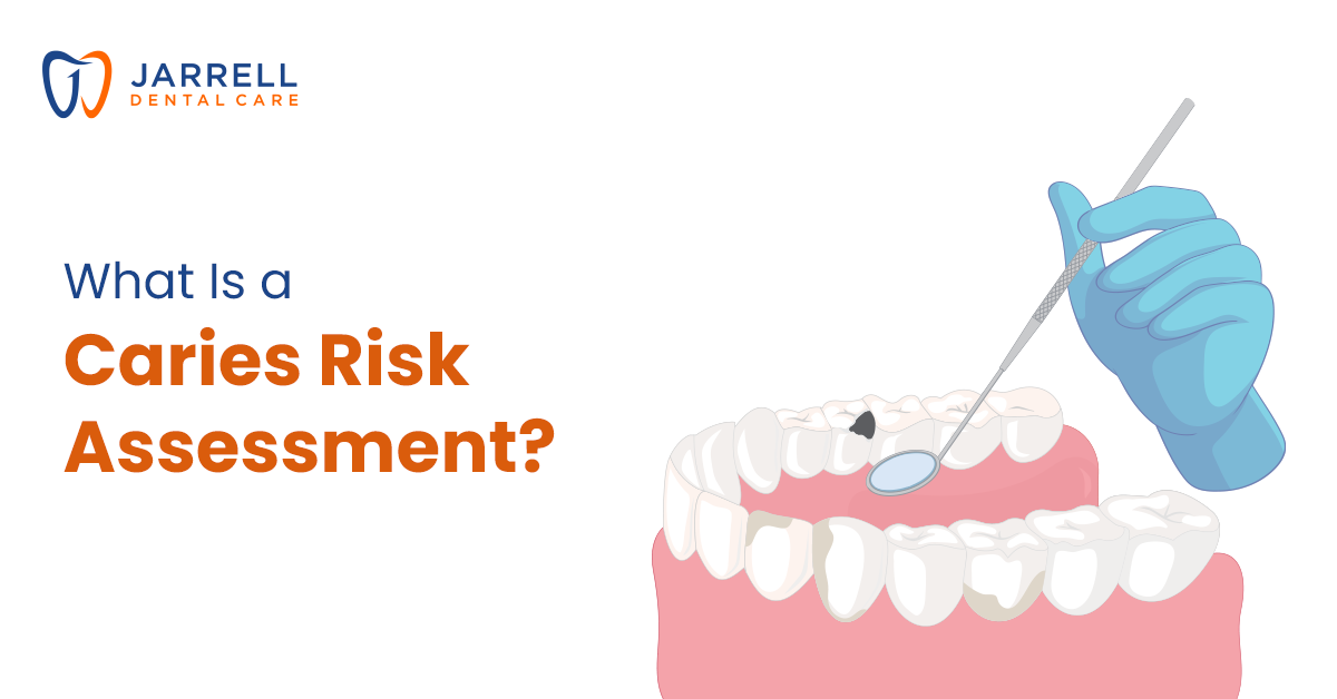 Caries Risk Assessment: A Tool For Prevention