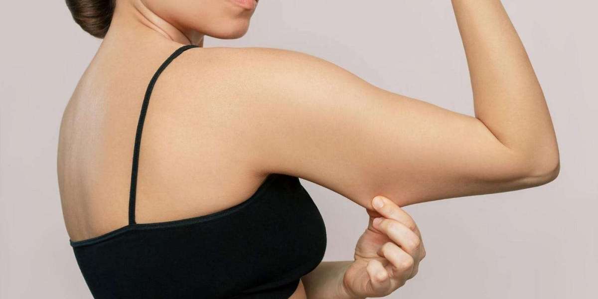 Debunking Myths About Arm Lift Surgery in Dubai