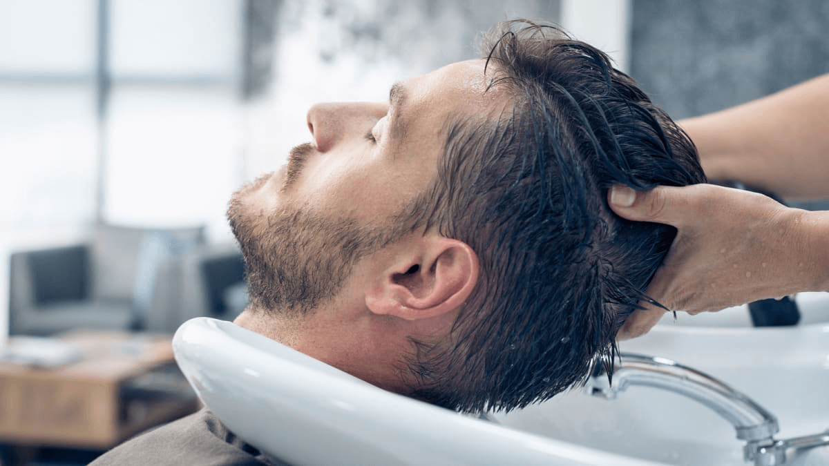 Male Hair Loss: Causes, Stages & Impact on Daily Life