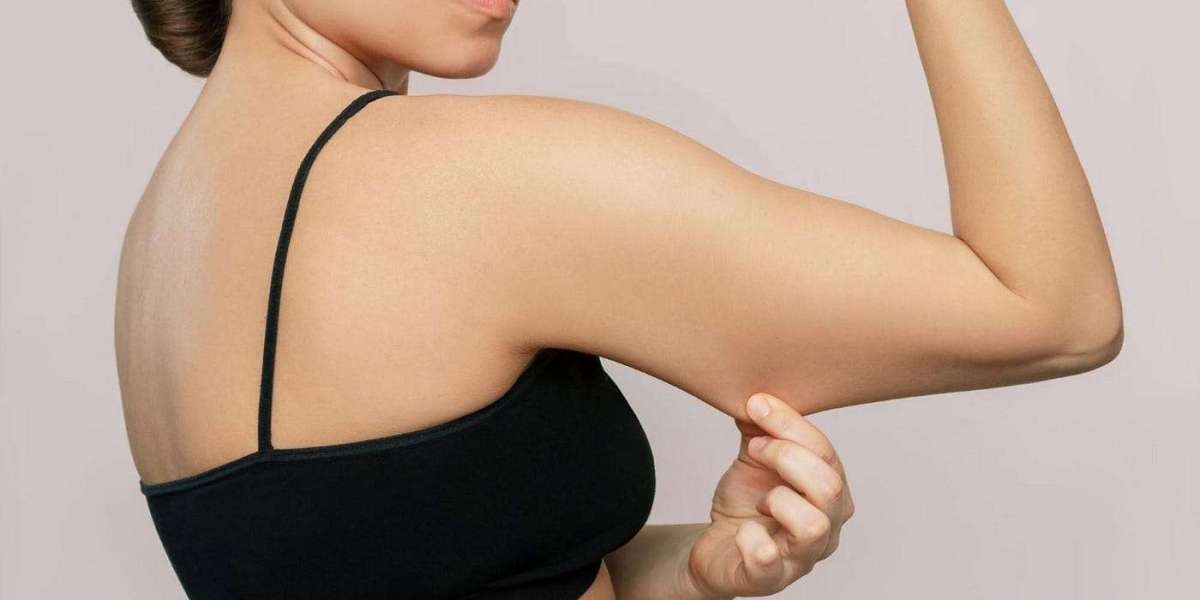 The Benefits of Combining Arm Lift Surgery with Other Procedures in Dubai