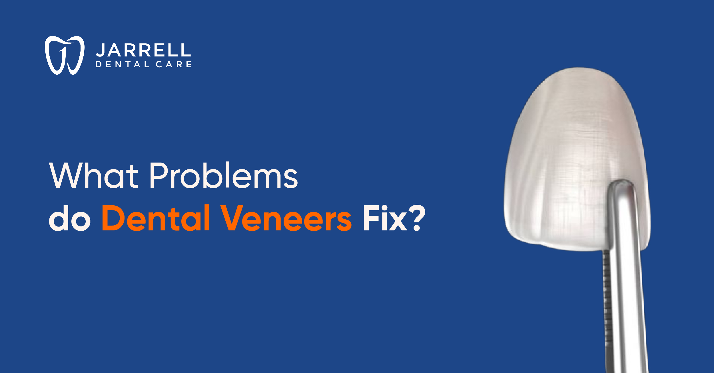 What Problems do Dental Veneers Fix? | Jarrell Dental Care