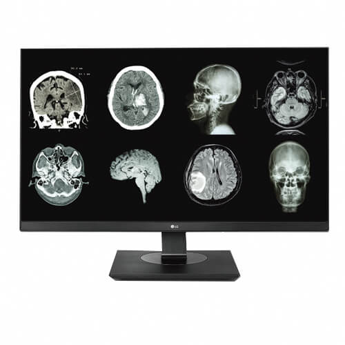 LG Clinical Review Monitor Display | Hiliex Inc.