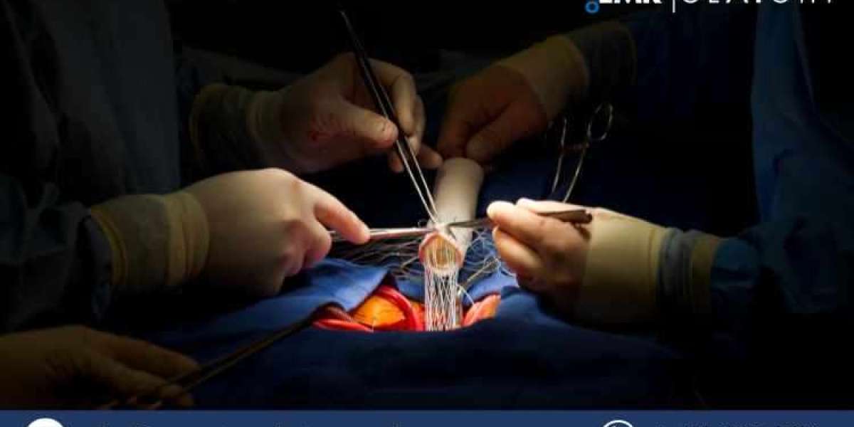 Aortic Valve Replacement Devices Market Size, Share, Trends, Growth, Analysis, Report and Forecast 2024-2032