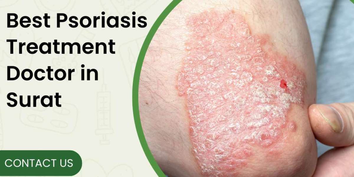 Best Psoriasis Treatment in Surat: Healing with Ayurvedic Care by Vaidya Yogesh Vani