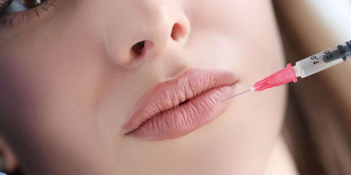 What Are the Benefits of Getting Lip Injections in Calgary?