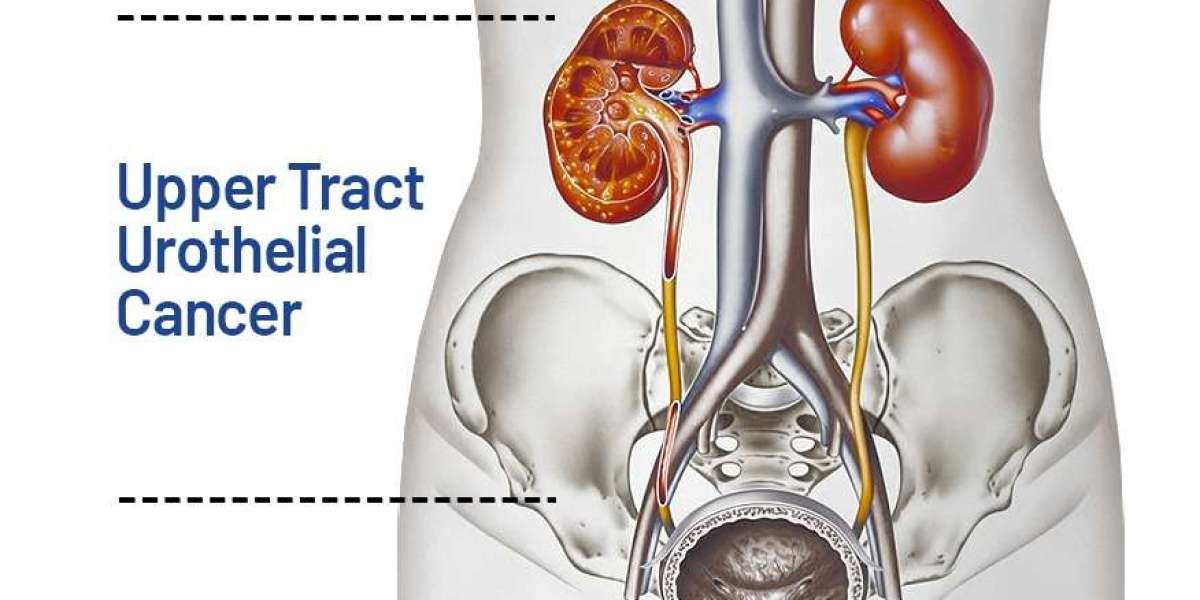 Urothelial Carcinoma Market Share, Industry Size, Trends, Forecast 2024-34