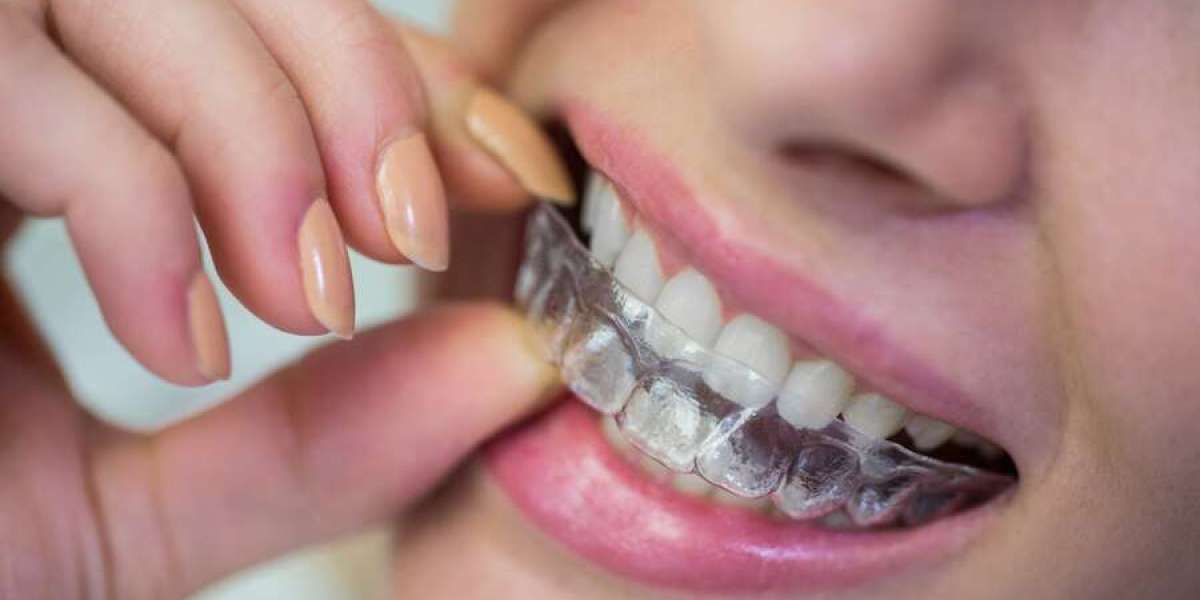 Spain Clear Aligners Market: Analysis of Trends and Growth Potential