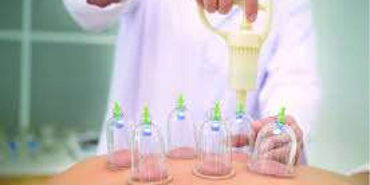 Hijama: A Time-Tested Method for Optimal Health