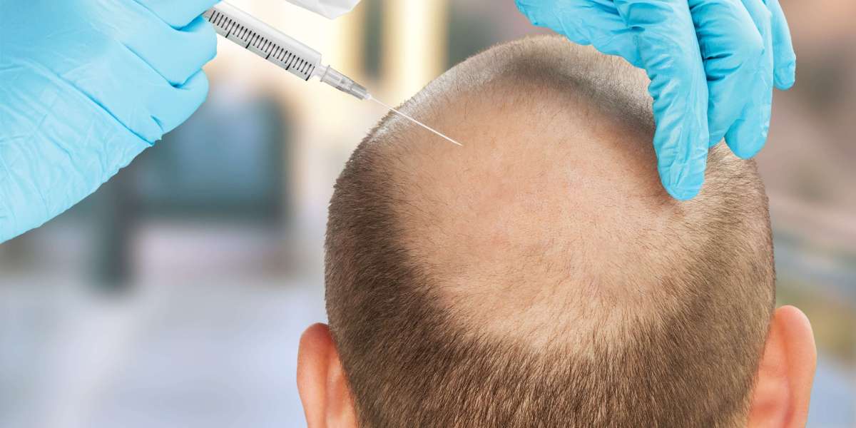 Transform Your Look with Expert Hair Transplant in Kota at IFT Hair Science