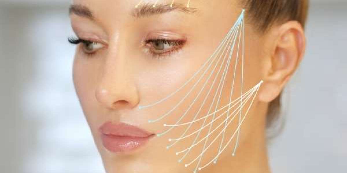 Thread Lift for Jawline Sculpting: Achieve a Sharp, Defined Look