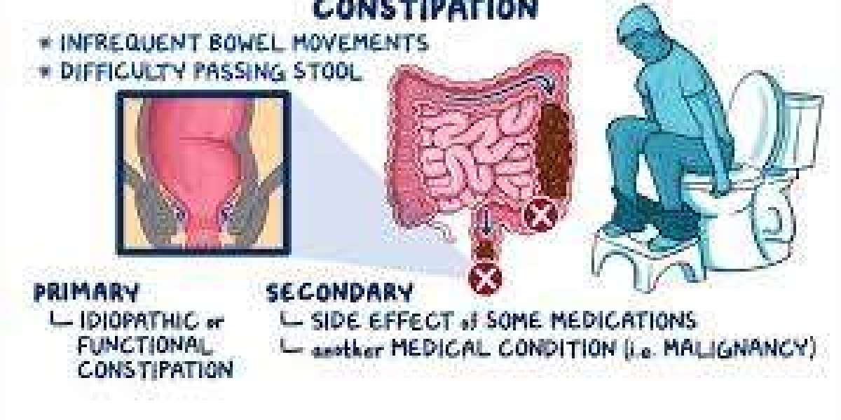 Constipation: Causes, Symptoms, and Effective Remedies