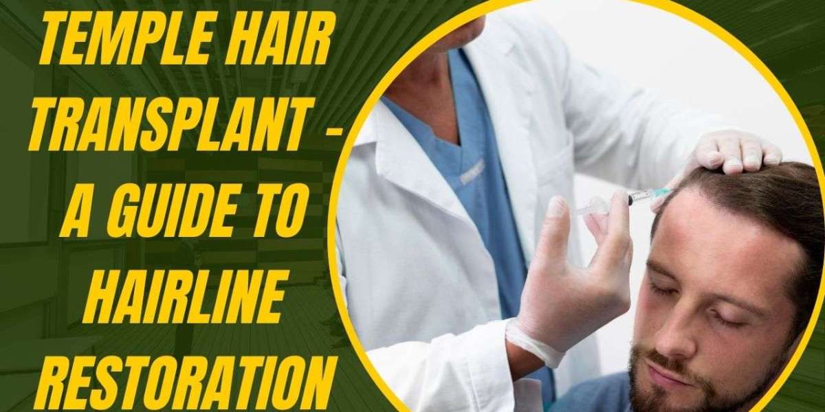 Temple Hair Transplant – A Guide to Hairline Restoration