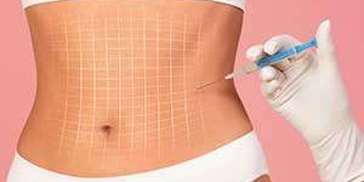 Expert Opinions on Fat Melting Injection in Dubai