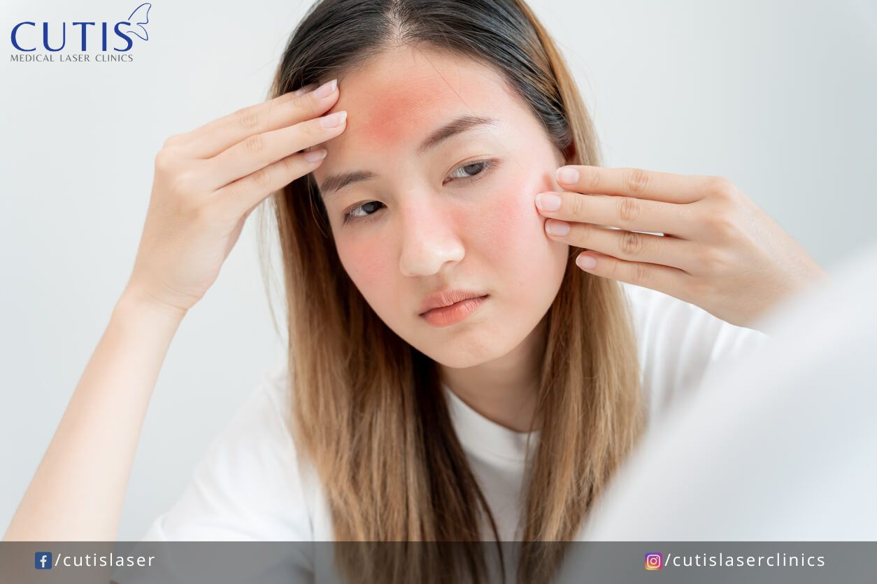 Facial Redness or Rosacea? Learn the Key Differences